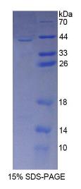 SDS-PAGE (CD209-7173H).jpg